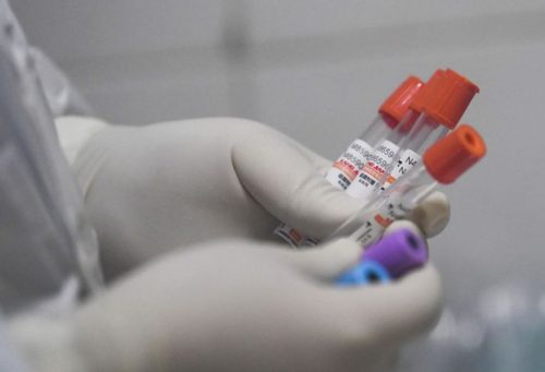 В Тверской области не выявлено новых случаев коронавирусной инфекции